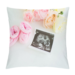 Personality  Ultrasound Picture Of A Baby With Pink Baby's Bootees Pillow Covers