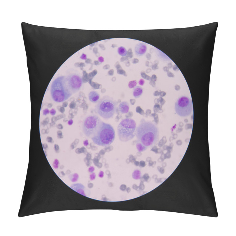 Personality  Mesothelial Malignant Cells With Multiple Nuclei Pillow Covers