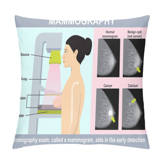 Personality  Mammography Infographics. Woman Get Mammograms For Breast Cancer Screening. Illustration About Protection Breast Cancer With Medical Technology. Using Low Energy X-rays To Examine The Woman Breast. Pillow Covers