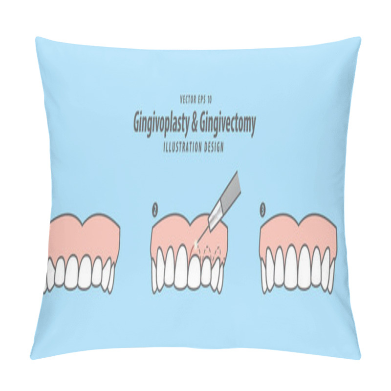 Personality  Gingivoplasty & Gingivectomy Step (upper) Electrosurgery Cut Gum Pillow Covers