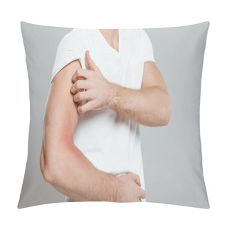 Personality  Partial View Of Man Scratching Hand With Allergy Isolated On Grey Pillow Covers