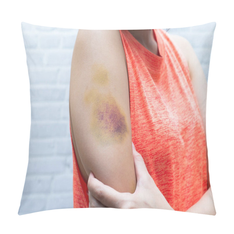 Personality  Bruise On Woman Arm. Injection Bruises. Doctor And Patient. Pillow Covers