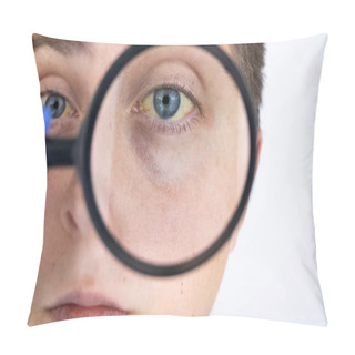 Personality  The Yellow Color Of The Male Eye. Symptom Of Jaundice, Hepatitis Or Problems With The Gall Bladder, Gastrointestinal Tract, Liver. Pillow Covers