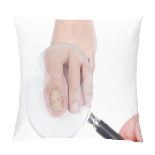 Personality  Doctor Dermatologist Examines The Nail On The Presence Of The Fu Pillow Covers