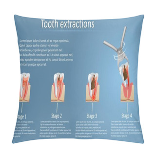 Personality  Tooth Extraction Concept Vector Poster Banner Template Pillow Covers