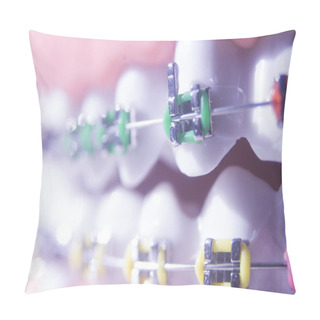 Personality  Modern Metal Brackets Aligner Straighterners Used To Correct Alignment On Teeth By Dentists. Pillow Covers
