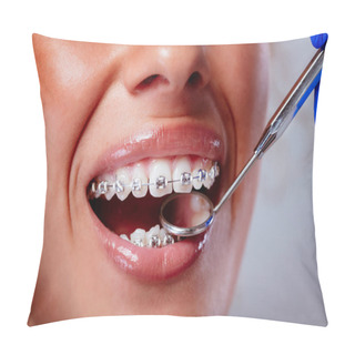 Personality  Close-up Of A Dentist Checking Braces With A Dental Mirror On The Female Patient.  Pillow Covers