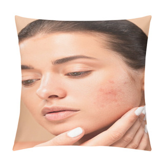 Personality  Young Woman Touching Face With Problem Skin Isolated On Beige  Pillow Covers