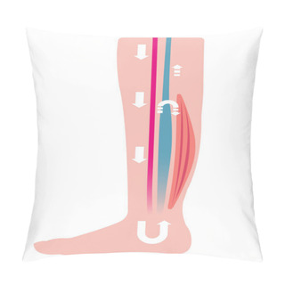 Personality  Cause Of Swelling(edema) Of The Legs. Water In The Blood Stagnates And Venous Pressure Rises. Flat Illustration. Pillow Covers