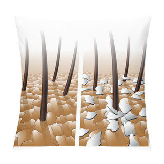 Personality  Dandruff Hair Problem. Pillow Covers
