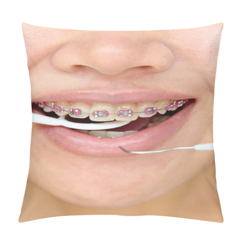 Personality  Girl Smiling With Braces On Teeth Pillow Covers