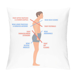 Personality  Upper And Lower Crossed Syndrome Medical Diagram. Crooked Man With Muscle Strength Imbalance. Weak And Overactive Muscles Therapy. Incorrect Spine Curvature Caused By Bad Posture. Vector Illustration. Pillow Covers