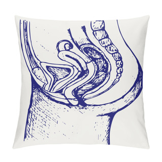 Personality  Female Urinary System Pillow Covers