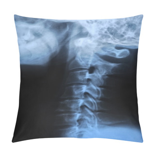 Personality  Human Body's Radiograph Pillow Covers
