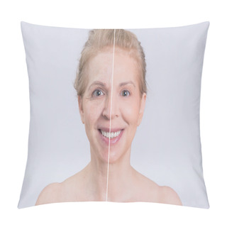 Personality  Before And After Sking Treatment Pillow Covers