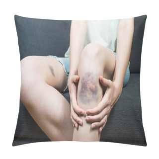Personality  Bruise Injury On Young Girl Knee Pillow Covers