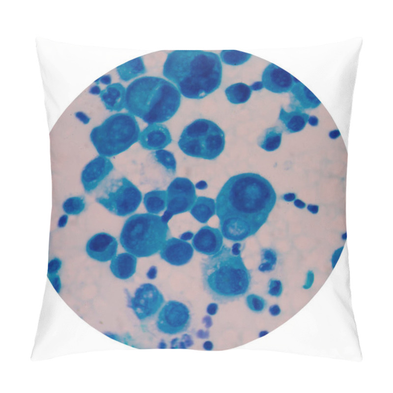 Personality  Malignant Cells With Multiple Nuclei And Prominent Nucleoli.Meso Pillow Covers