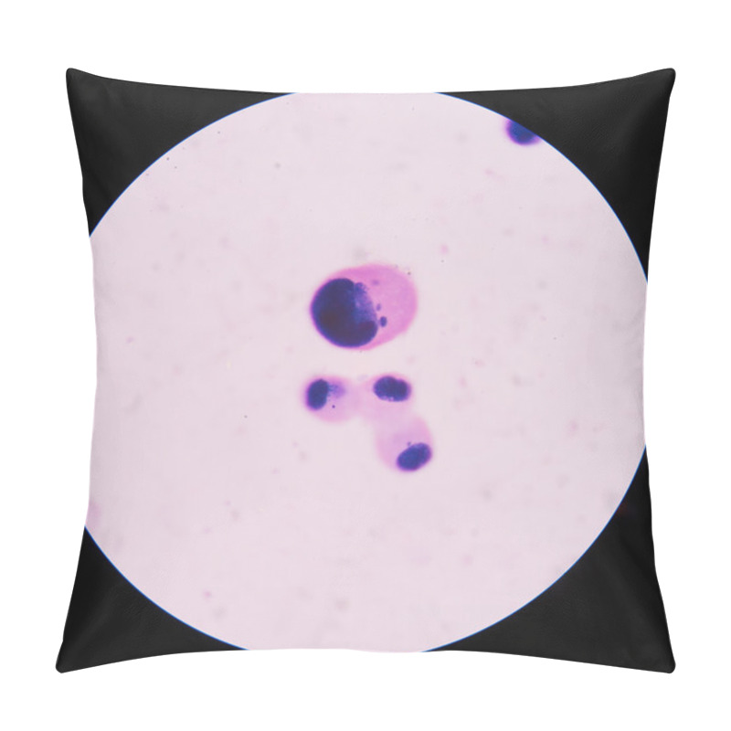 Personality  Mesothelial Cells In Body Fluid. Pillow Covers