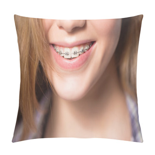 Personality  Portrait Of Teen Girl Showing Dental Braces. Pillow Covers