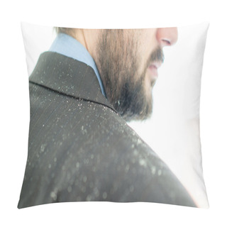 Personality  A Man Having Man Dandruff In The Hair Pillow Covers