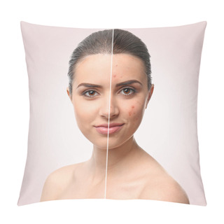 Personality  Woman Face Before And After Acne Treatment Procedure. Skin Care Concept. Pillow Covers