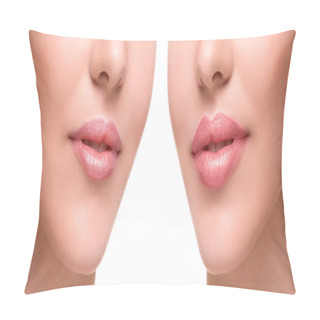 Personality  Lips  Before And After Augmentation Pillow Covers