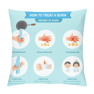 Personality  How To Treat A Burn Infographic,vector Illustration Pillow Covers