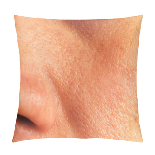Personality  Oily Skin On The Face Pillow Covers
