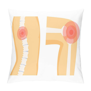 Personality  Spine Orthopedic Pain Set, Vector Illustration Pillow Covers