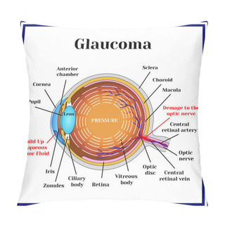 Personality  Normal Vision. Glaucoma. Pillow Covers