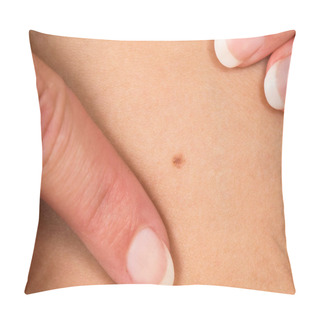 Personality  Check The Sign On The Skin For Cancer. Pillow Covers