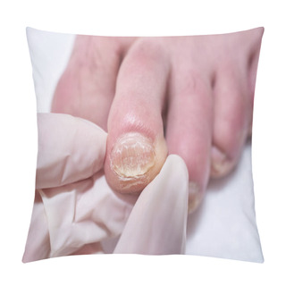 Personality  Podiatrist Treating Feet During Procedure, Examines The Foot. Professional Medical Pedicure. Podiatry Clinic Foot Treatment. Pillow Covers