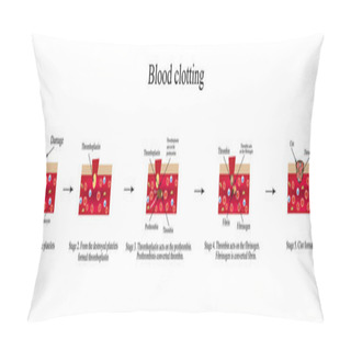 Personality  Blood Clotting. Infographics. Vector Illustration Pillow Covers