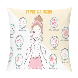 Personality  Girl With Types Of Acne On The Yellow Background Pillow Covers