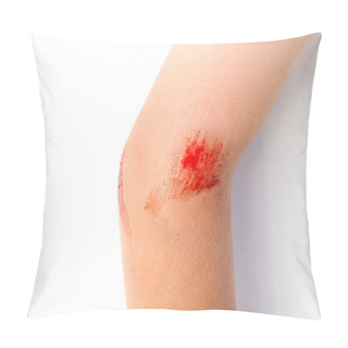 Personality  Child With Arm Injury Pillow Covers