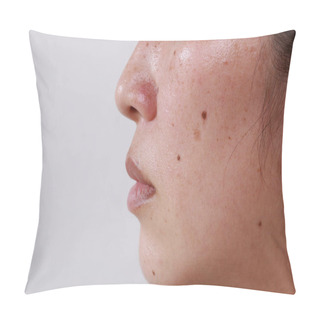 Personality  Facial Skin Problems For Women And Health Problems Dark Spots With Freckles And Blemishes With Copy Space Pillow Covers
