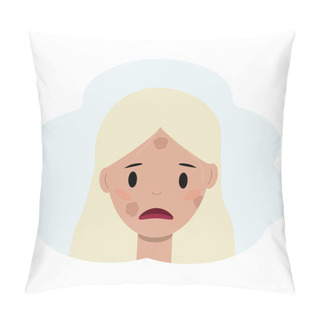 Personality  Illustration Of A Young Woman Face With Pigmentation. Facial Skin Care Concept Pillow Covers