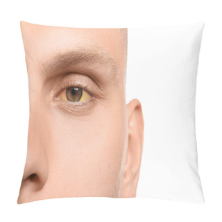 Personality  Young Man With Yellow Eyes On White Background, Closeup. Hepatitis Symptom Pillow Covers