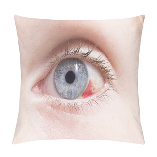 Personality  Eye Care Pillow Covers