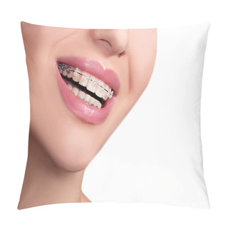 Personality  Braces Teeth Female Smile Pillow Covers
