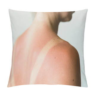 Personality  Close-up Of A Sunburn Marks On A Woman's Back Pillow Covers