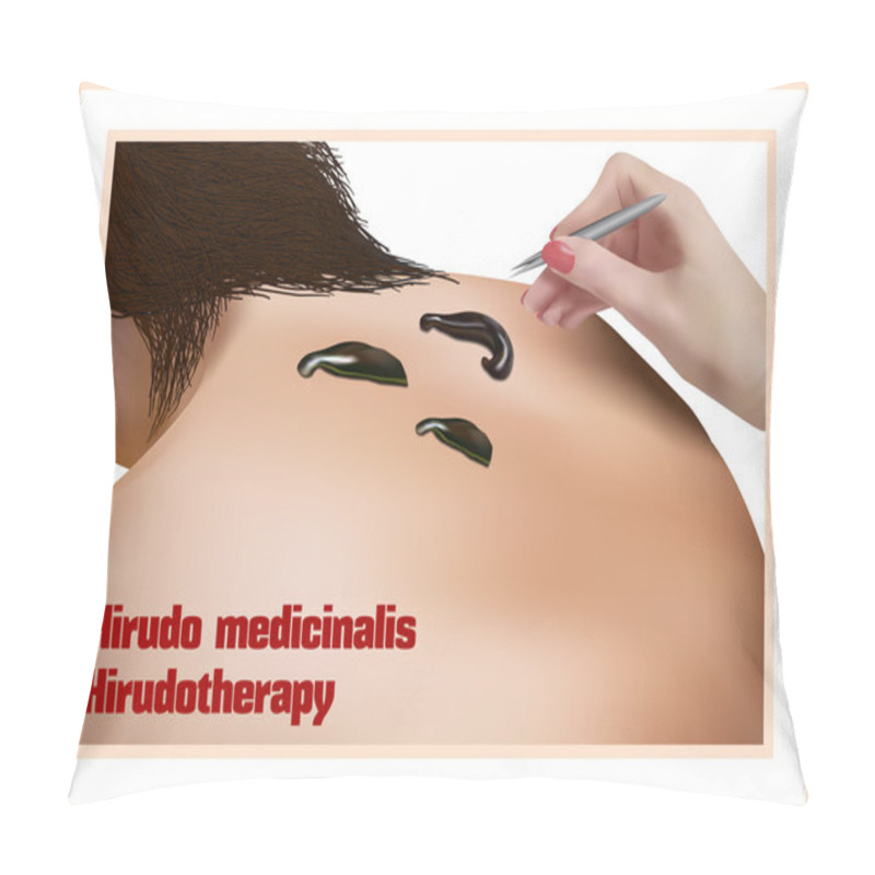 Personality  Hirudotherapy. Treatment with leeches. pillow covers