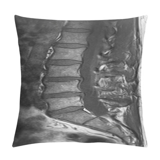 Personality  CT Scans Of Human Spine Pillow Covers