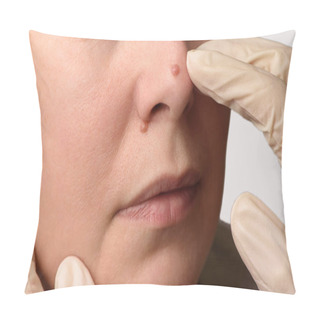 Personality  Diagnosis Of Skin Mole Or Nevus On Woman's Face. Doctor's Hands In Surgical Gloves Examining Nevi On Nose. Checking Moles Concept. Closeup Pillow Covers