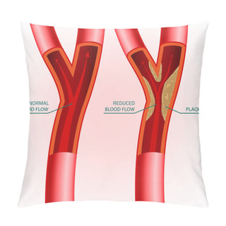 Personality  Blood Vein Image Pillow Covers