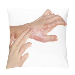 Personality  Treatment Of Burns On Female Hand Isolated On White Pillow Covers