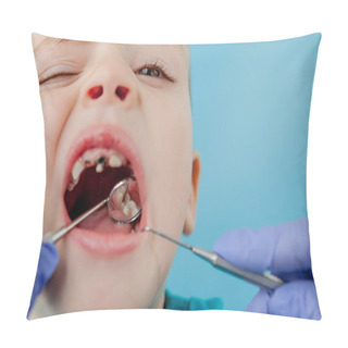Personality  Dentist Examining Boy's Teeth On Blue Background. A Small Patient In The Dental Chair Smiles. Dantist Treats Teeth. Close Up View Of Dentist Treating Teeth Of Little Boy In Dentist Office. Pillow Covers