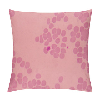 Personality  Large Platelets On Blood Smear Red Blood Cells Background. Pillow Covers