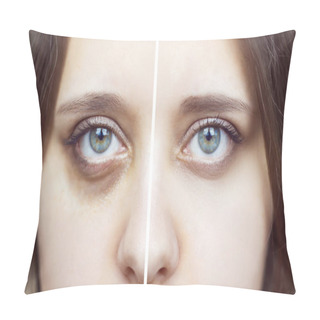 Personality  Female Green Eyes With Bruises Under Eyes Before And After Cosmetic Treatment Pillow Covers