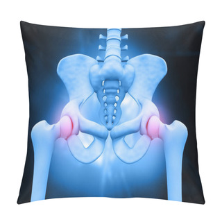 Personality  3d Illustration Of Hip Skeleton. Pelvis Pain		 Pillow Covers